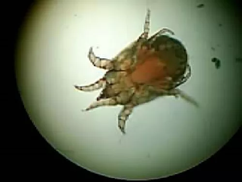 Sarna sarcoptes scabiei (&aacute;caro de la sarna)